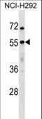Ubiquitin Specific Peptidase 27 X-Linked antibody, LS-C160472, Lifespan Biosciences, Western Blot image 