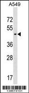 1-Acylglycerol-3-Phosphate O-Acyltransferase 5 antibody, 60-111, ProSci, Western Blot image 