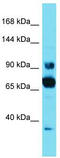 Coiled-Coil Domain Containing 178 antibody, TA334875, Origene, Western Blot image 