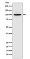Catenin Alpha 3 antibody, M05039, Boster Biological Technology, Western Blot image 