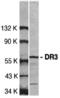 TNF Receptor Superfamily Member 25 antibody, A03227, Boster Biological Technology, Western Blot image 