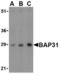 B Cell Receptor Associated Protein 31 antibody, TA306283, Origene, Western Blot image 