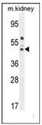 Corticosteroid-binding globulin antibody, AP53859PU-N, Origene, Western Blot image 