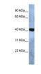 Transmembrane Protein 115 antibody, NBP1-62560, Novus Biologicals, Western Blot image 