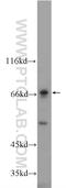 Matrix Metallopeptidase 21 antibody, 55289-1-AP, Proteintech Group, Western Blot image 