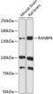 RAN Binding Protein 6 antibody, 15-562, ProSci, Western Blot image 