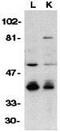 DNA Fragmentation Factor Subunit Beta antibody, GTX31640, GeneTex, Western Blot image 