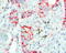 Catenin Beta 1 antibody, LS-C796681, Lifespan Biosciences, Immunohistochemistry frozen image 