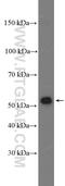 Acyl-CoA Synthetase Family Member 3 antibody, 25484-1-AP, Proteintech Group, Western Blot image 