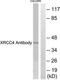 DNA repair protein XRCC4 antibody, TA312413, Origene, Western Blot image 