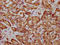 Family With Sequence Similarity 83 Member G antibody, LS-C680448, Lifespan Biosciences, Immunohistochemistry paraffin image 