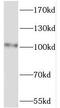 PWP2 Small Subunit Processome Component antibody, FNab06964, FineTest, Western Blot image 