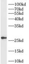 RAB33B, Member RAS Oncogene Family antibody, FNab10126, FineTest, Western Blot image 