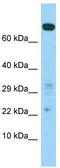 Bifunctional coenzyme A synthase antibody, TA331317, Origene, Western Blot image 