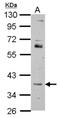 Forkhead Box R2 antibody, NBP2-16525, Novus Biologicals, Western Blot image 