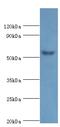 Amylase Alpha 2A (Pancreatic) antibody, MBS1493848, MyBioSource, Western Blot image 