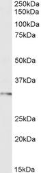 Forkhead Box I1 antibody, 45-613, ProSci, Enzyme Linked Immunosorbent Assay image 