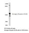 Glucagon receptor antibody, LS-C177156, Lifespan Biosciences, Western Blot image 