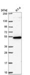 G-Patch Domain Containing 4 antibody, NBP2-55313, Novus Biologicals, Western Blot image 
