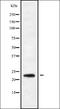 RAB9B, Member RAS Oncogene Family antibody, orb338634, Biorbyt, Western Blot image 