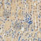 Platelet Derived Growth Factor Receptor Beta antibody, A2180, ABclonal Technology, Immunohistochemistry paraffin image 