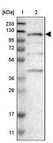 Coiled-Coil Domain Containing 186 antibody, PA5-53704, Invitrogen Antibodies, Western Blot image 