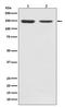 FGFR-2 antibody, M00231, Boster Biological Technology, Western Blot image 