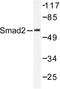 HsMAD2 antibody, AP06413PU-N, Origene, Western Blot image 
