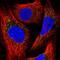 Peroxisomal Biogenesis Factor 13 antibody, NBP2-38204, Novus Biologicals, Immunocytochemistry image 
