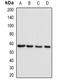 SET And MYND Domain Containing 1 antibody, orb341272, Biorbyt, Western Blot image 