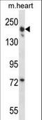 Capping Protein Regulator And Myosin 1 Linker 3 antibody, LS-C165872, Lifespan Biosciences, Western Blot image 