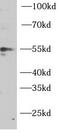 Phosphatidylinositol-3,4,5-trisphosphate 3-phosphatase and dual-specificity protein phosphatase PTEN antibody, FNab10258, FineTest, Western Blot image 