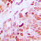 GATA Binding Protein 1 antibody, LS-C358759, Lifespan Biosciences, Immunohistochemistry paraffin image 