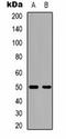 Calcium Voltage-Gated Channel Auxiliary Subunit Beta 3 antibody, orb323236, Biorbyt, Western Blot image 