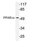 Peroxisome proliferator-activated receptor alpha antibody, AP20267PU-N, Origene, Western Blot image 