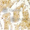 Major Vault Protein antibody, A1980, ABclonal Technology, Immunohistochemistry paraffin image 