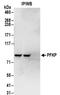 Phosphofructokinase, Platelet antibody, NBP2-32192, Novus Biologicals, Immunoprecipitation image 