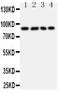 Interleukin 4 Receptor antibody, PA1618, Boster Biological Technology, Western Blot image 