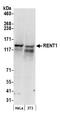 UPF1 RNA Helicase And ATPase antibody, NB100-368, Novus Biologicals, Western Blot image 