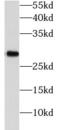 Phosphoglycerate Mutase 1 antibody, FNab06345, FineTest, Western Blot image 