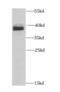 Heterogeneous Nuclear Ribonucleoprotein A1 antibody, FNab03946, FineTest, Western Blot image 