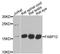 Fatty acid-binding protein 12 antibody, A9894, ABclonal Technology, Western Blot image 