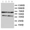 C-C Motif Chemokine Receptor 5 (Gene/Pseudogene) antibody, PA1016-1, Boster Biological Technology, Western Blot image 