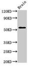 RAC-gamma serine/threonine-protein kinase antibody, orb401272, Biorbyt, Western Blot image 