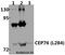 Centrosomal Protein 76 antibody, A12507-1, Boster Biological Technology, Western Blot image 