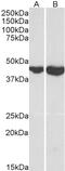 Capping Actin Protein, Gelsolin Like antibody, 43-521, ProSci, Enzyme Linked Immunosorbent Assay image 