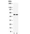ALDH2 antibody, R31890, NSJ Bioreagents, Western Blot image 