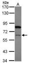 Zinc Finger Protein 449 antibody, NBP1-32591, Novus Biologicals, Western Blot image 