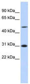 Inhibitor of growth protein 3 antibody, TA333745, Origene, Western Blot image 