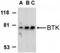 Bruton Tyrosine Kinase antibody, NBP1-76596, Novus Biologicals, Western Blot image 